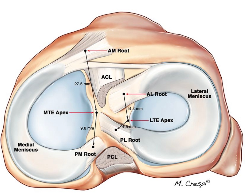 Image Un acide hyaluronique pour traiter les lésions méniscales : HYMOVIS®